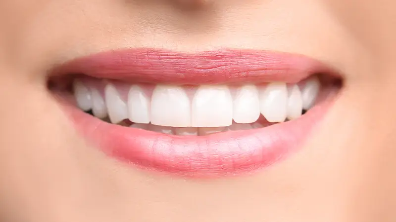 smile with dental bonding