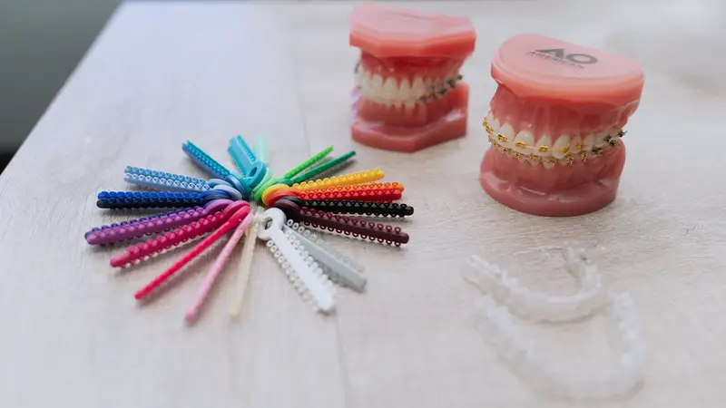 clear and metal braces with different color bands and invisalign showing orthodontic options